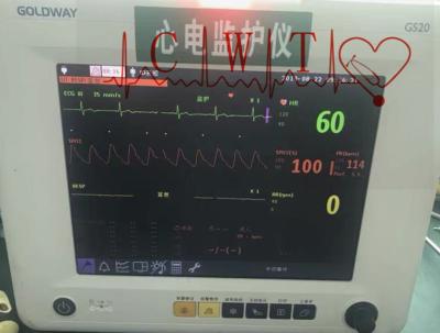 China 12.1“ de Multiparameter Vital Signs Monitor Repair, Volwassen Gezondheidszorg Controlesysteem van TFT Te koop