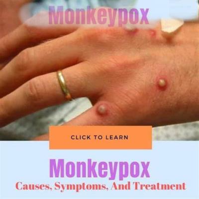 Κίνα Επικυρωμένο CE PCR Monkeypox εξαρτήσεων δοκιμής δοκιμής rt-Pcr Monkeypox ξέσπασμα Monkeypox δοκιμής προς πώληση