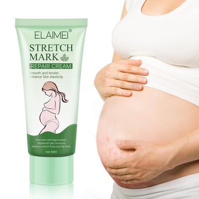 China Natural Herbal Skin Revitalizer Stretch Marks Creams Remove Stretch Marks Fade Scars Moisturizing Whitening Stretch Marks Removal Cream for sale