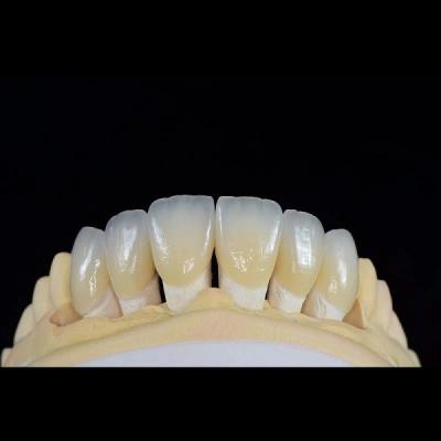 Cina Fabbricazione in zirconia stratificata con finitura dentale di porcellana feldspatica in vendita