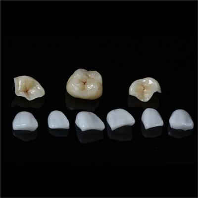 China Diente Todo porcelana IPS Emax Inlay Onlay carilla Estética en odontología en venta