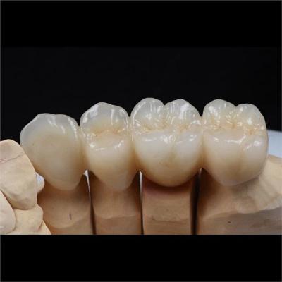 Chine Dentiste en céramique de zirconium biocompatible Restaurations de couronne dentaire sur mesure à vendre