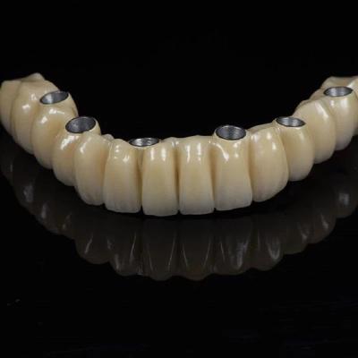 Chine Tout sur 6 PFM Titane pont dentelle couronne pleine voûte implant à vendre