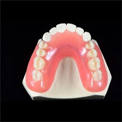 Chine Prothèse acrylique partielle supérieure inférieure amovible pour les dents manquantes à vendre