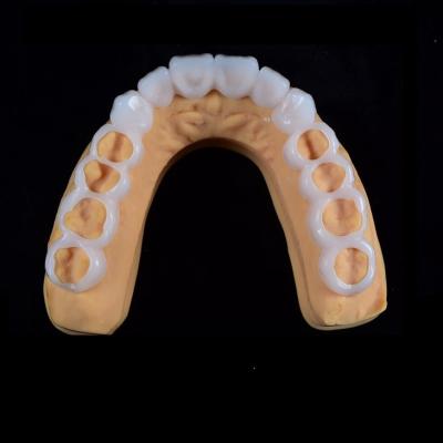 Chine Des dents en silicone réglables et des facettes de sourire à vendre