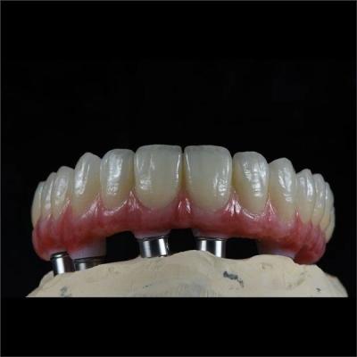 Chine ODM Implants en zirconium à pleine voûte pont Implants en zirconium dentisterie holistique à vendre