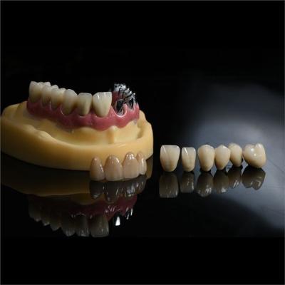 China Dentistas Fundação Cad Cam PFM Crown Ceramic Material Metal à venda