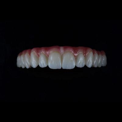 China Full Coutour Arch Zirconia Vaste gebitten Kroon Biocompatibel materiaal Te koop