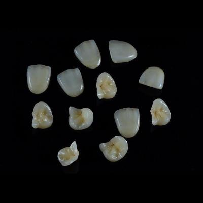 Cina Restituzioni dentali IPS EMax Inlay Onlay Tutto porcellana Altamente resistente in vendita