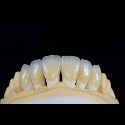 China Dental Lab Teeth Feldspathic Porcelain Veneers Custom Shaped for sale