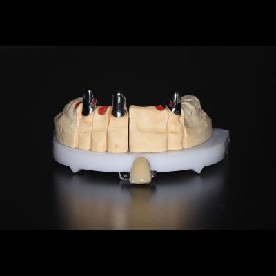 China Removable Telescopic Partial Denture China Dental Lab For Missing Teeth for sale