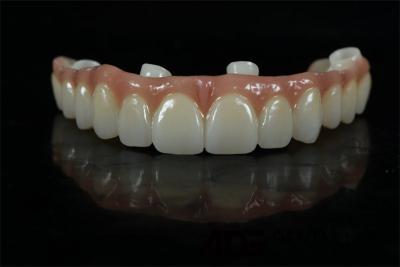 China Implantes dentales de precisión Coronas y puentes Abutment personalizado en venta