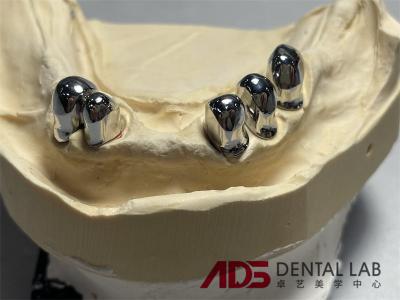 China Telescopic Precision Attachment Partial Full Dentures Crown Prosthesis OEM for sale