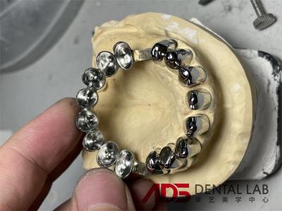 China Metal Cylindrical Precision Attachment Denture Telescoper Crown For Dental Prosthesis for sale