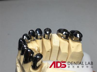 China Custom Metal precision Attachment Partial Denture Telescoper for sale