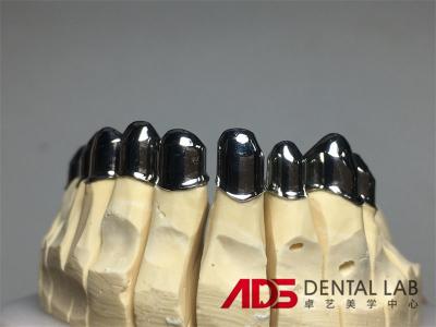 China China Dental Lab Dental Implant Attachments Adjustable Telescopic for sale