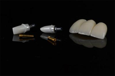 China China Laboratorio Dental Cemento Implante retenido Prótese de corona para dientes artificiales en venta