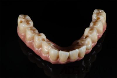 China Implantes dentales OEM de titanio cilíndrico de puente completo Todos en 4 6 en venta