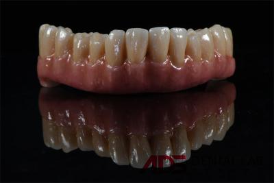 China Titanium Zirconia Implant Supported Dental Bridge All On 4 6 for sale