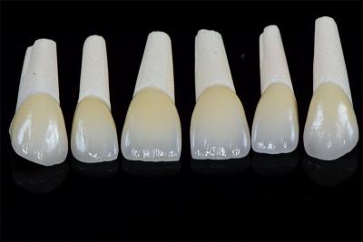 Cina Caramelle di porcellana dentale bianca resistente alle macchie in vendita