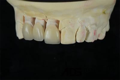 Chine Dentistique Porcelaine naturelle Faisceaux dentaires Faisceau feldspatique 0,5 mm-0,7 mm à vendre