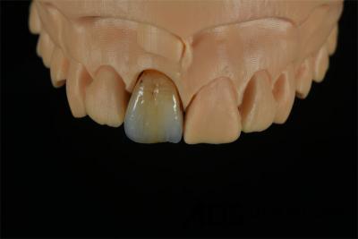 China Coroa dentária de zircônio fabricada pela China à venda