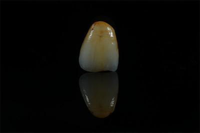 China Precieze wit porselein gelaagd zirconia vlek met Emax OEM Te koop