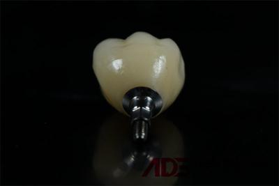 Chine Laboratoire dentaire en Chine Seramique à vis en zirconium Implant dentaire retenu Remplacement d'une seule dent à vendre