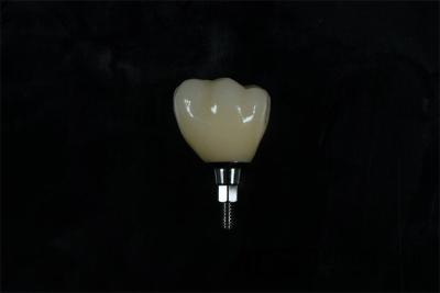 China Cylindrical Titanium Zirconia Screw Retained Dental Implant Natural Looking for sale