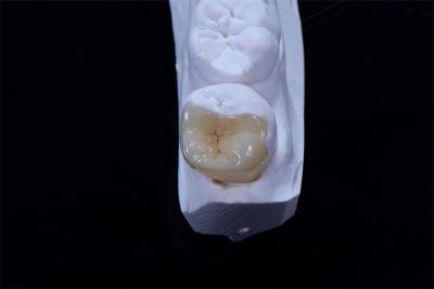 China Dental Crown Composite Inlays And Onlays Restoration Customized Shape for sale