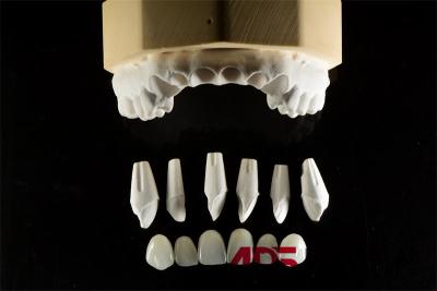 Cina Finestre feldspatiche di porcellana dentale per denti su misura in vendita