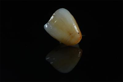 China China-Based Dental Lab: Natural Shade Zirconia Crown - High Strength Restoration for sale