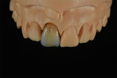 China Coronas de zirconia asequibles con tinción de color personalizada - Laboratorio Dental de China en venta