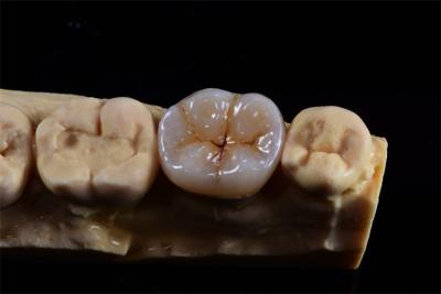 Cina Corona di zirconia stratificata per estetica naturale dal laboratorio dentale cinese in vendita