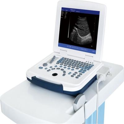 China RA-580 Laptop Metal BW 12inch LED Core Portable Ultrasound Scanner for sale