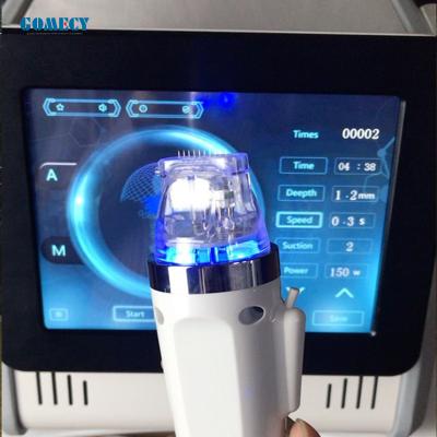 China 300W No Irradiation Tixel Rf Fractional Machine Acne Scar Removal for sale