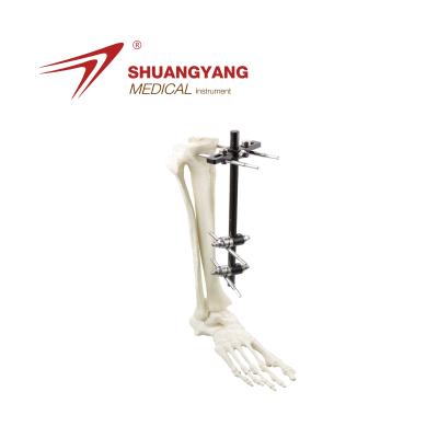 China Stainless / Carbon Fiber Humerus, Tibia, Ankle Fragement Fixator Small Orthopedic Modular External Instrument for sale