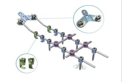 China Hinteres zervikales internes Dorn-Fixierungs-System, Pedikelschraube-System zu verkaufen