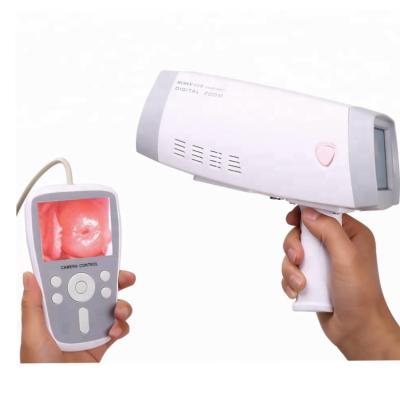 China Plastic Handheld Vaginal Camera Medical Digital Electronic Colposcope For Checking Woman's Cervix for sale