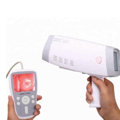 China Plastic Medical Portable Digital Sony Camera Video Digital Colposcope Price for sale