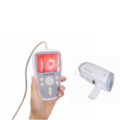 China Portable Plastic Medical Equipment Digital Camera Vaginoscope Colposcope for sale