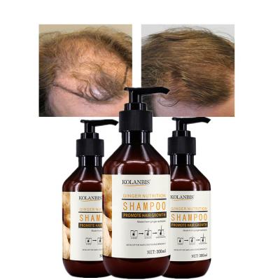 China Color-Protecting KOLANBIS Hair Thickened Shampoo Ginger Extract Baldness Treatment For Men Women for sale