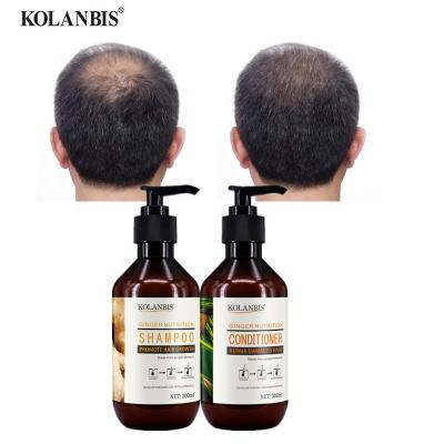 China Wholesale KOLANBIS Best Ginger Scalp Care Hair Regrowth Shampoo and Conditioner Set Hair Loss Protection Treatment for Bald Head for sale