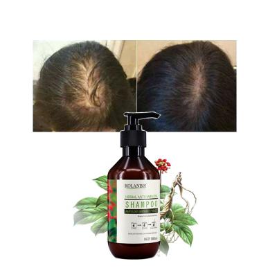 China Wholesale Organic Fast Hair Regrowth Panax Ginseng Shampoo Anti Loss Prevention KOLANBIS Hair Loss Treatment Hair Loss Treatment for sale