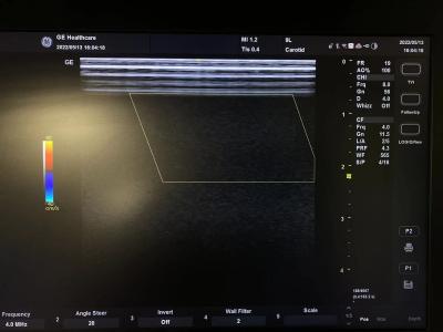 중국 GE VividE 원형 선형 초음파 탐사 9L-RS, GE 초음파 변환기 3.3-10.0 Mhz 판매용