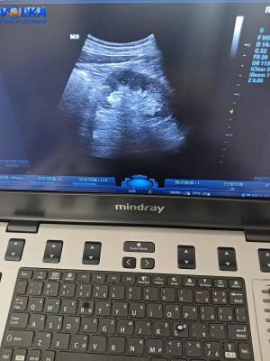 China Mindray Laptop Original Ultrasound System M9 Curved array for sale