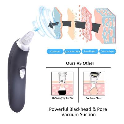 China 2019 New Product Blackhead Makeup Remover Tool Kit Black Head Hot Beauty Personal Skin Care Instrument for sale