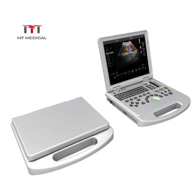 China High Configuration 3D 4D Color Laptop Hospital Doppler Portable Cardiac Ultrasound Machine zu verkaufen