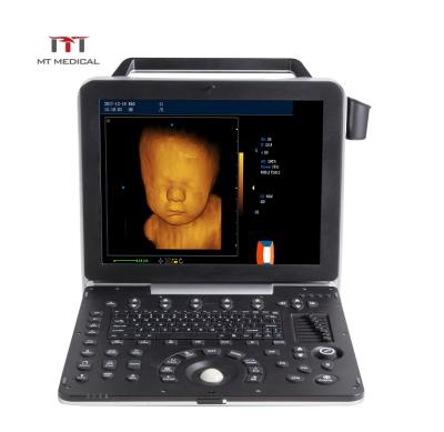 中国 Portable Metal Equipment Ultrasonic Laptop Echo Color Doppler 4D Cardiac Ultrasound Machine 販売のため