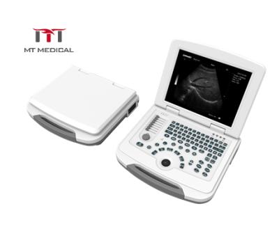 China High Specification Portable Metal Laptop Ultrasound Scanner Machine zu verkaufen